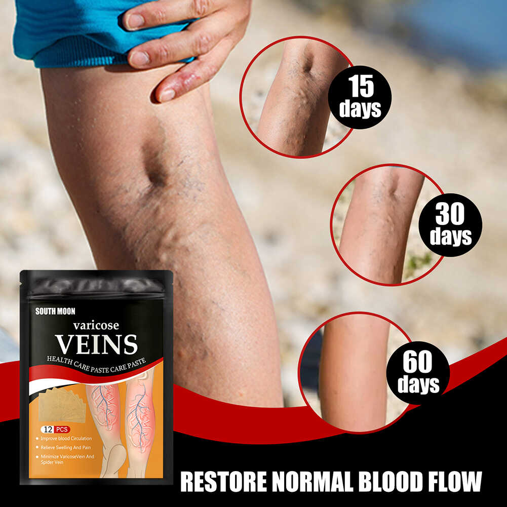 VenoCare Parches (Pack de 12 Unidades)
